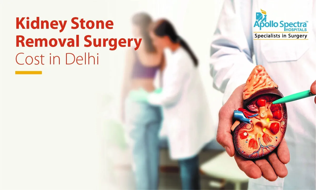 Kidney Stone Removal Surgery Cost in Delhi